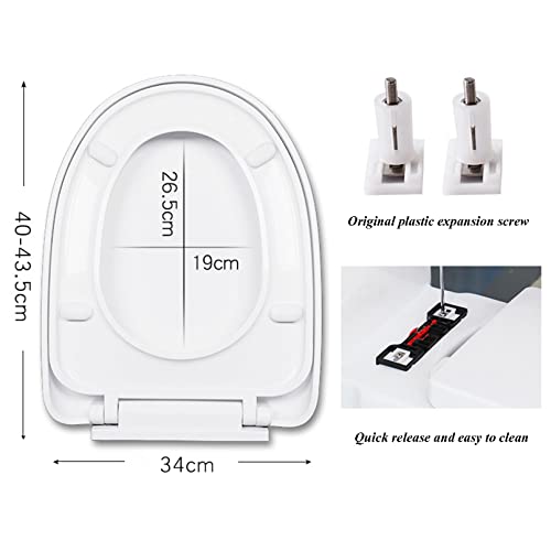 "Soft Close Toilet Seat with Quick Release – Design for Easy Cleaning & Installation, Top Fix/Bottom Fixed, White"
