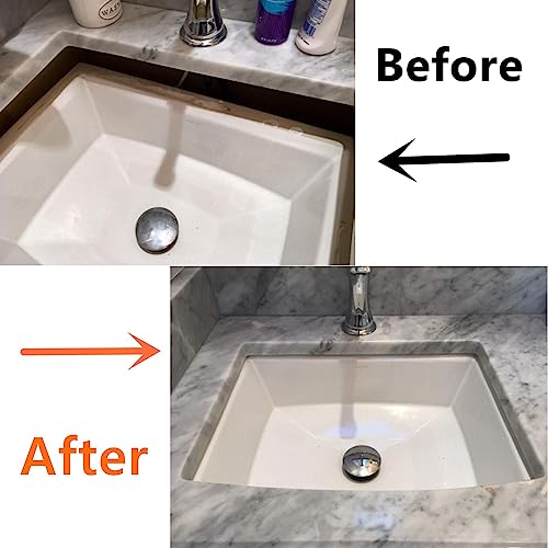 Complete Sink Repair Kit System-Undermount Sink Installation Kit- Bracket for kitchen (Patent)