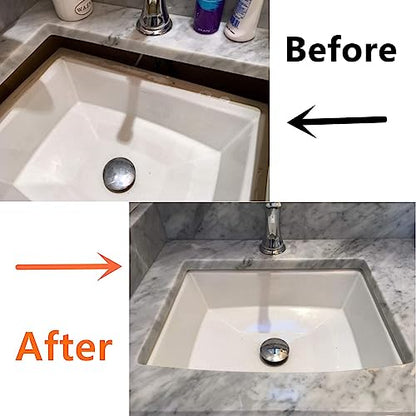 Complete Sink Repair Kit System-Undermount Sink Installation Kit- Bracket for kitchen (Patent)