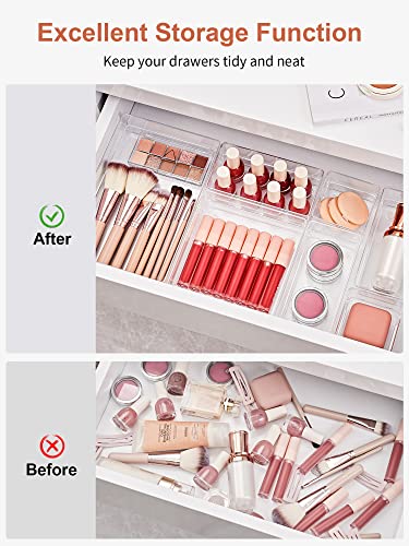 SMARTAKE 16 PCS Drawer Organizer, 5-Size Desk Bathroom Drawer Organizer | 5-Size Storage Tray with Non-Slip Silicone Pads for Makeup, Jewelries, Utensils in Bedroom Dresser, Office and Kitchen, Clear - size: Medium