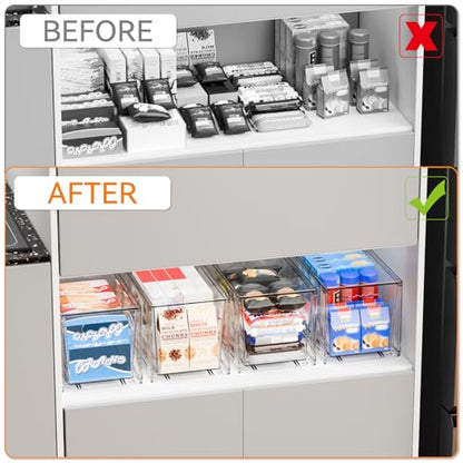 4 Pack Large Stackable Storage Drawers,11″Deep Under Cabinet Organizer,Baby Bottle Organizer,Clear Stacking Pull Out Drawer,Acrylic Storage Containers Bins for Organizing Snack,Medicine,Makeup